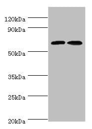 Polyclonal Rabbit anti-Human CREB3L2 / BBF2H7 Antibody (aa1-247, IHC, WB)