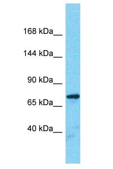 SORBS2 / ARGBP2 Antibody (aa251-300)