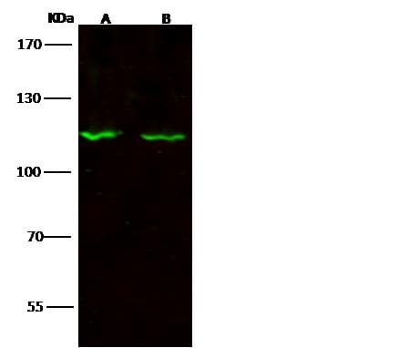 SIPA1 Antibody (Preservative Free)