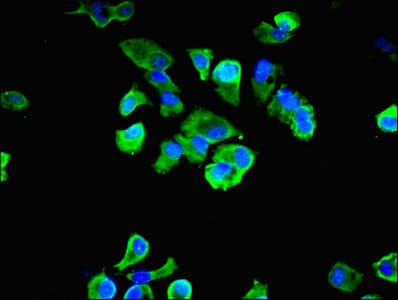 LBA / LRBA Antibody