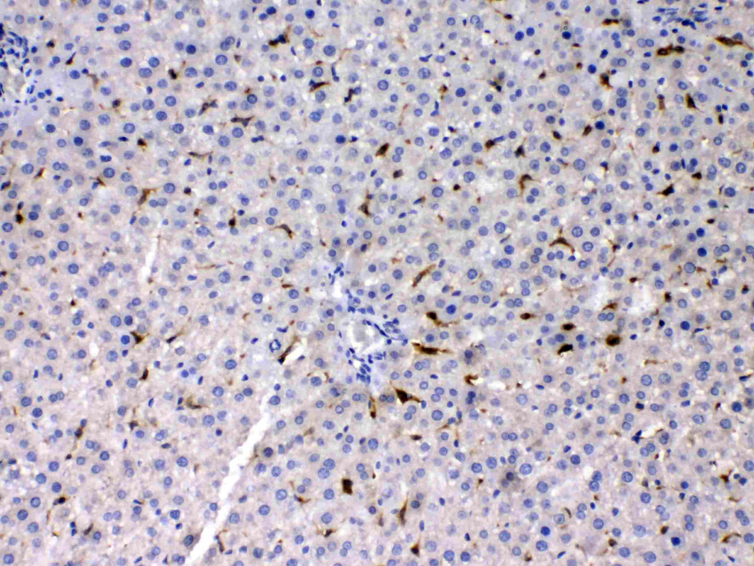 PSAT1 Antibody