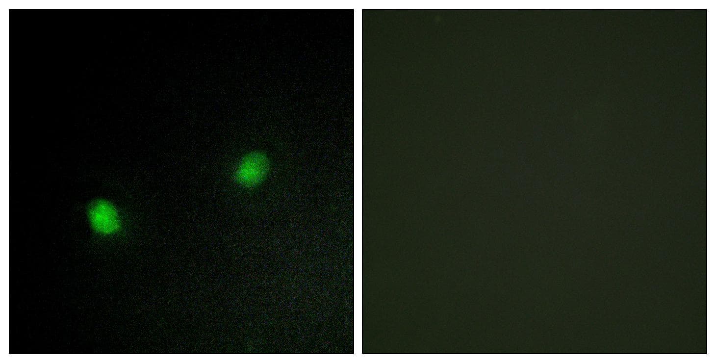 ZNF7 Antibody