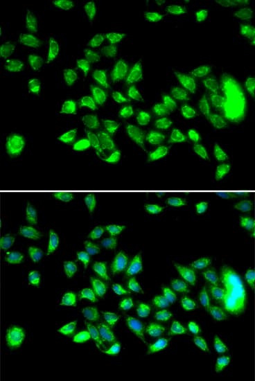 Polyclonal Rabbit anti-Human HYAL3 Antibody (IHC, IF, WB)