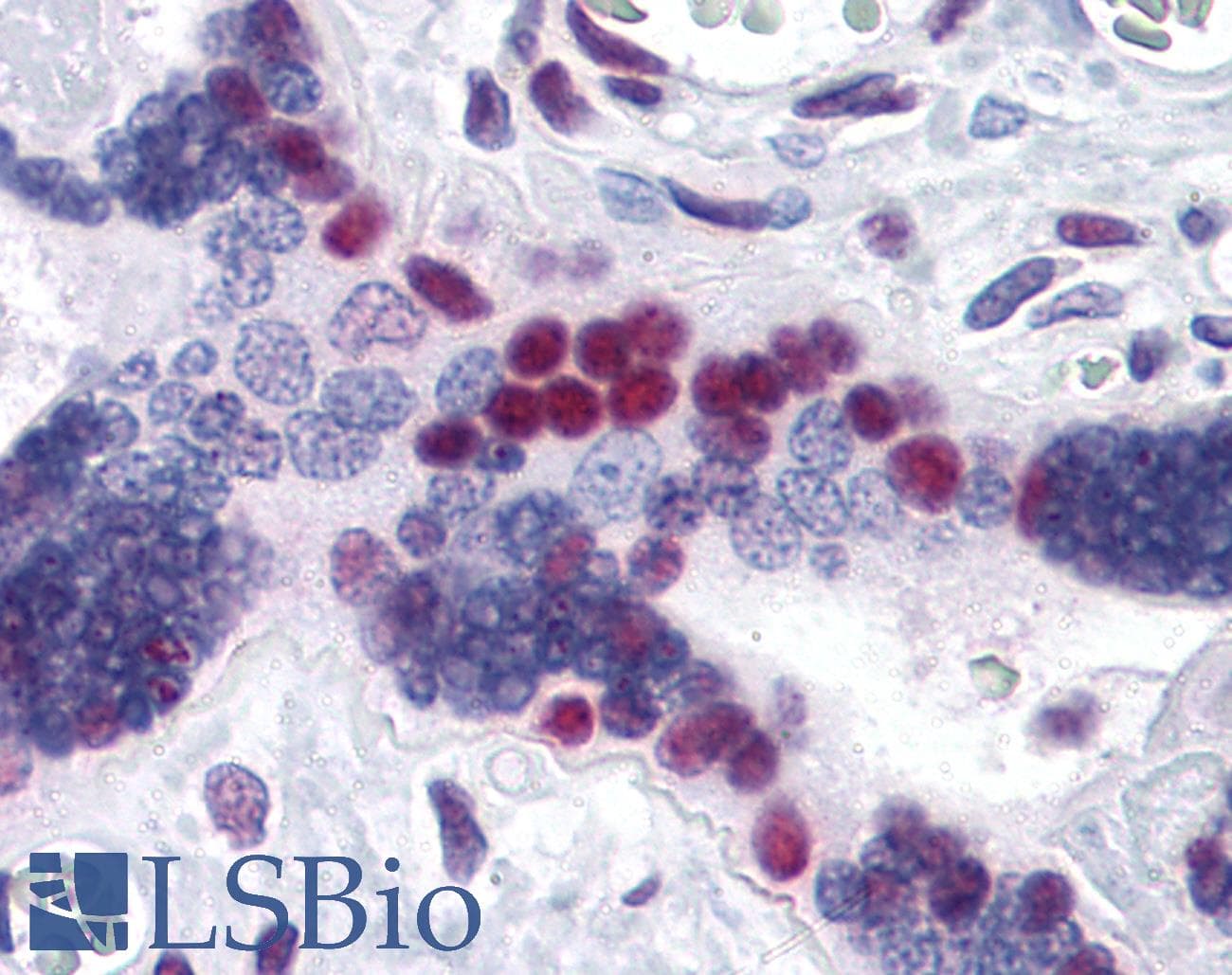 IHC-plus™ Monoclonal Mouse anti-Human MSI1 / Musashi 1 Antibody (clone 3F2, IHC, IF, WB)