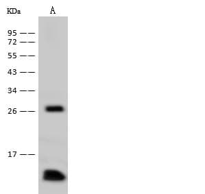 PFN1 / Profilin 1 Antibody