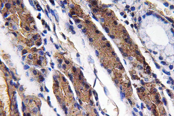 PGA5 / Pepsin A Antibody (aa258-307)