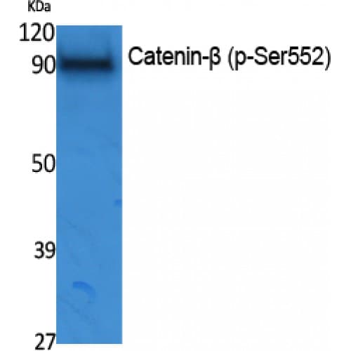 Polyclonal Rabbit anti-Human CTNNB1 / Beta Catenin Antibody (490-570 aa, WB)
