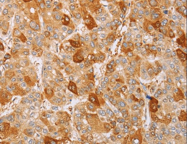 MCM5 Antibody