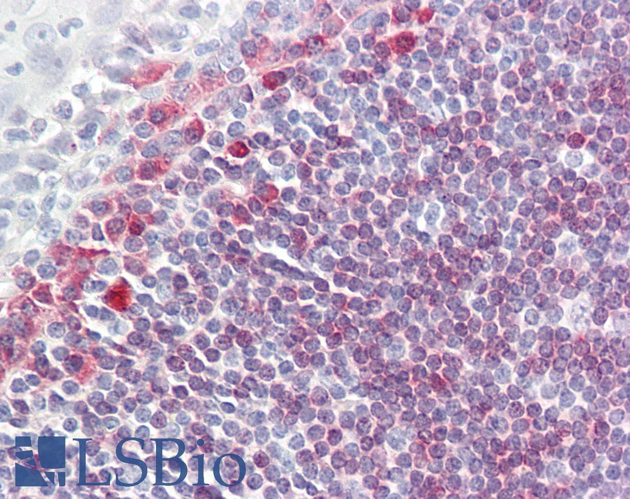 IHC-plus™ CD79A / CD79 Alpha Antibody