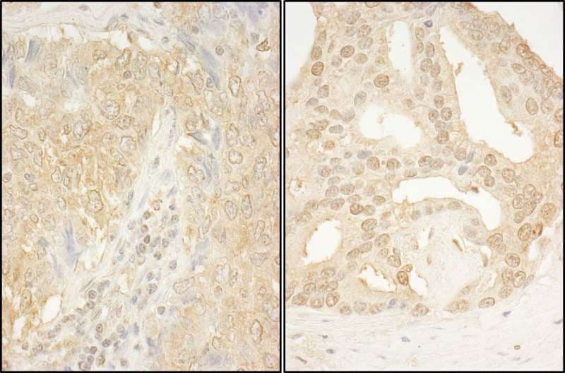 CAMKK1 Antibody (aa455-505)