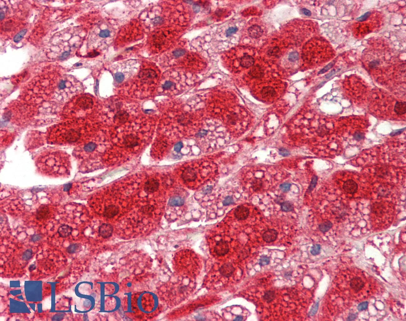 IHC-plus™ RDX / Radixin Antibody (aa466-495)