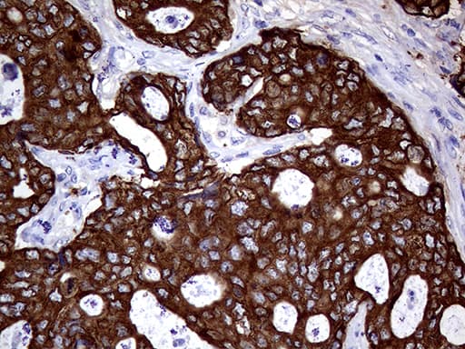 Monoclonal Mouse anti-Human AGR2 Antibody (clone OTI2B10, aa21-175, IHC, WB)