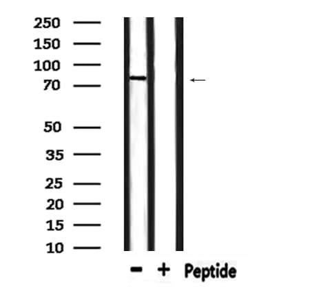LRRC41 Antibody