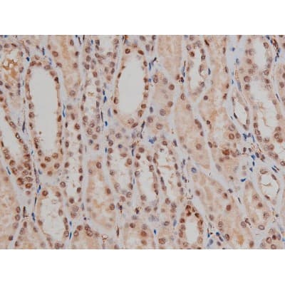 SP1 Antibody (phospho-Thr453)