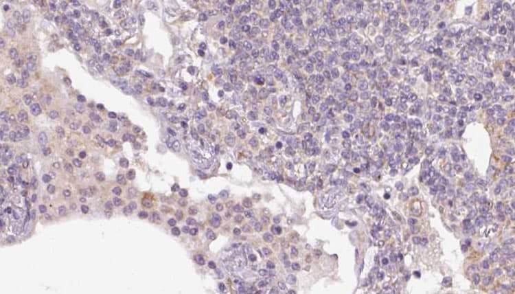 Polyclonal Rabbit anti-Human SEC24A Antibody (IHC, IF, WB)