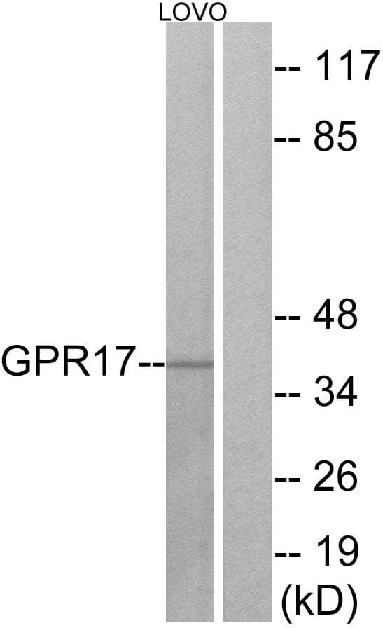 Polyclonal Rabbit anti-Human GPR17 Antibody (WB)