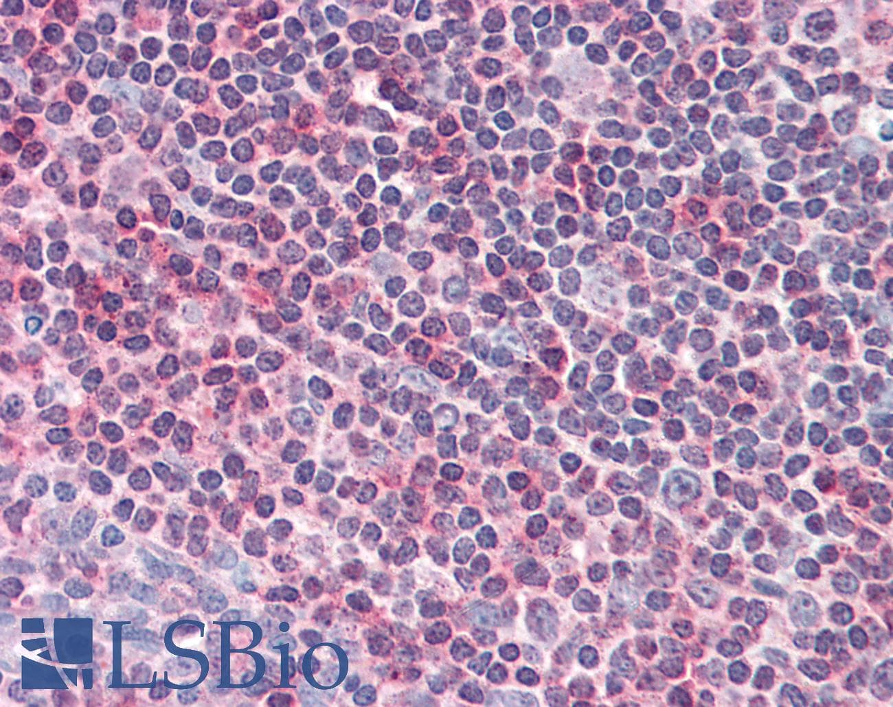 IHC-plus™ CENTB1 / ACAP1 Antibody (aa728-740)