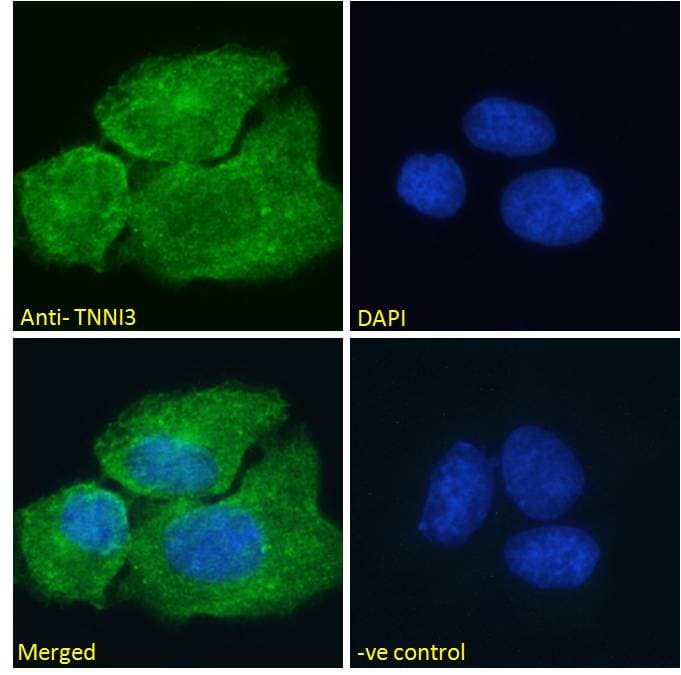Polyclonal Goat anti-Human TNNI3 / Cardiac Troponin I Antibody (aa117-127, IF, WB)