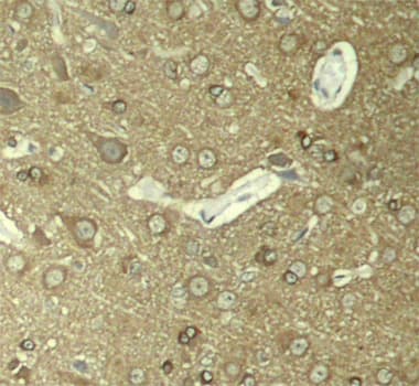 MAPT / Tau Antibody (phospho-Ser404)