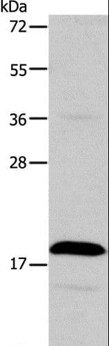 TSLP Antibody