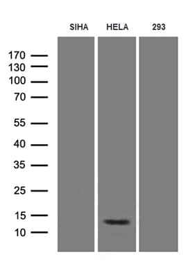 HPV18 E7 Antibody (clone OTI10D7)