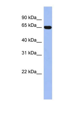 TRIM47 Antibody (aa431-480)