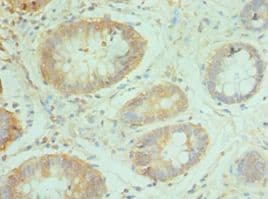 NCBP2 / CBP20 Antibody (aa1-156)