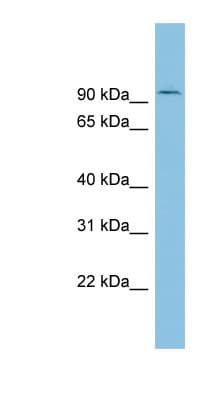 TLK1 Antibody (aa251-300)