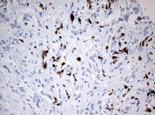 PBX1 Antibody (clone UMAB110)