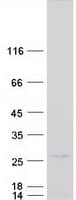 Human ZNF740 Protein (Recombinant Myc-DDK (Flag))