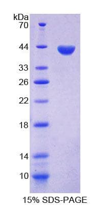 Human KRT33A / Keratin 33A / KRTHA3A Protein (Recombinant His-T7)