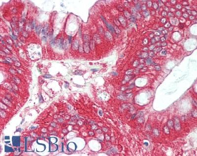 IHC-plus™ CTTN / Cortactin Antibody (aa450-500)