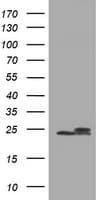 Monoclonal Mouse anti-Human NDUFB10 Antibody (clone OTI2G1, IHC, WB)