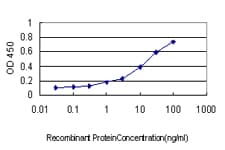 FHIT Antibody (clone 1C3)