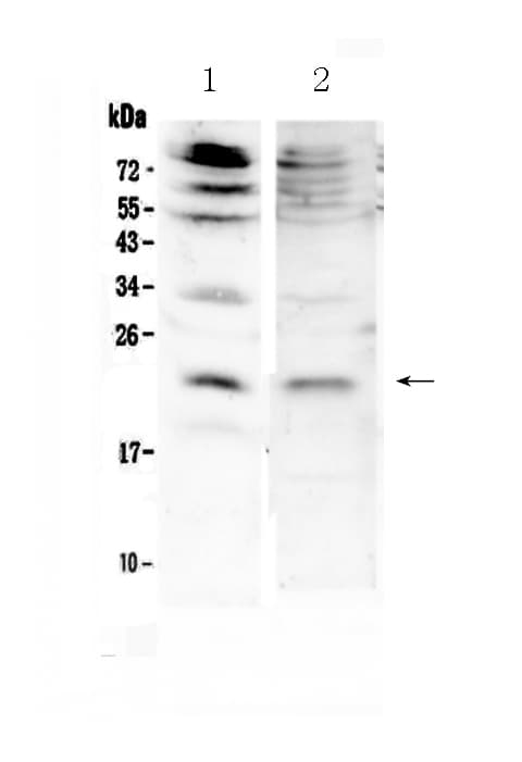 FGF7 / KGF Antibody