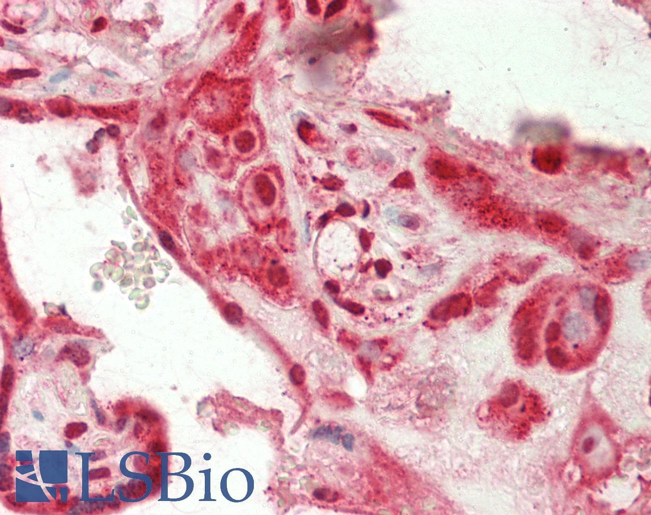 IHC-plus™ Polyclonal Rabbit anti-Human PLTP Antibody (aa470-490, IHC, WB)