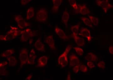ABHD11 Antibody