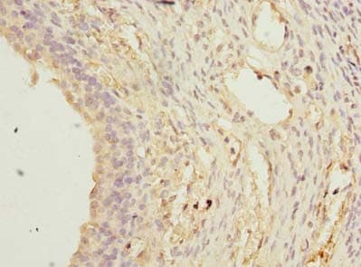 TCTEX1D2 Antibody
