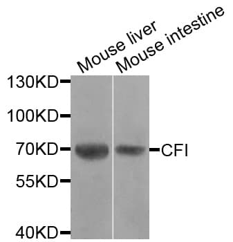 CFI / Complement Factor I Antibody
