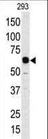 APOBEC1 Antibody (aa7-36)