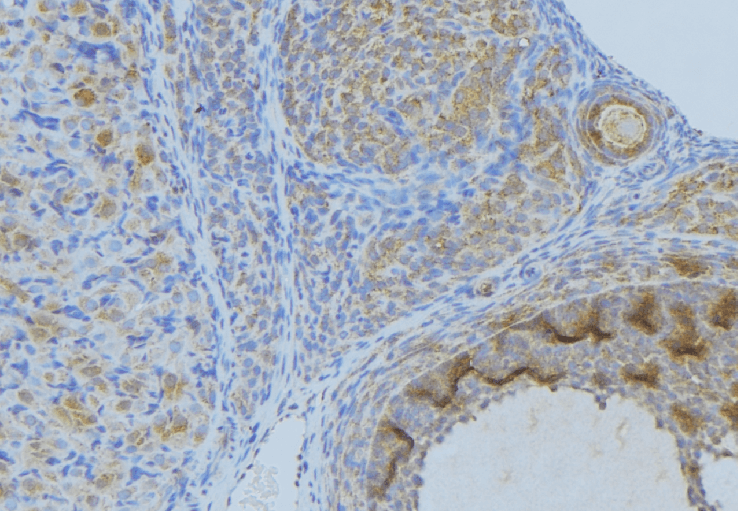 ANXA2 / Annexin A2 Antibody (phospho-Ser26)