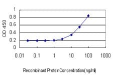 IHC-plus™ Monoclonal Mouse anti-Human DLD / Diaphorase / E3 Antibody (clone 3C1, IHC, WB)