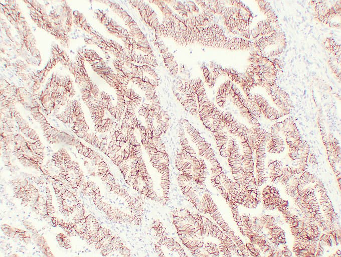 CLDN7 / Claudin 7 Antibody (clone ABT-CLD7)