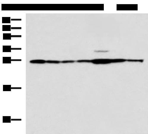 RPL10A Antibody