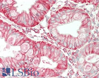 CDCP1 Antibody (clone 2B8, Carrier-free)