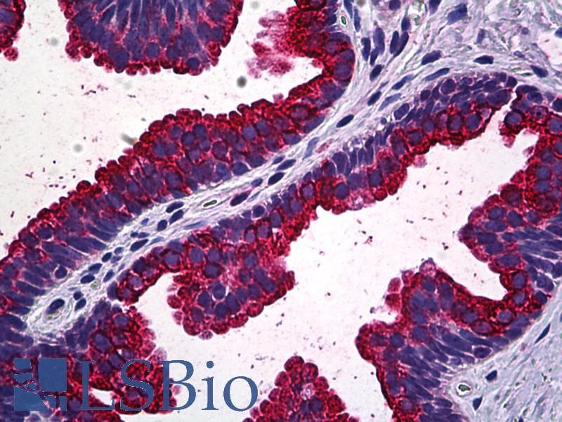 IHC-plus™ MAPK13 / p38delta Antibody (clone 1E11)