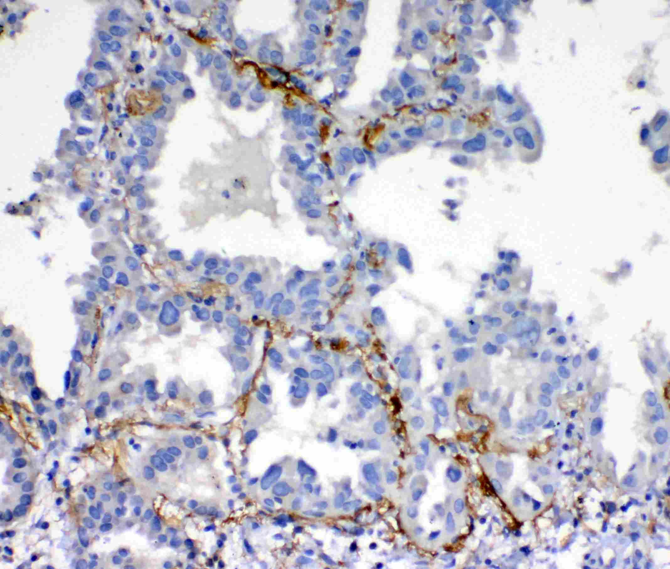 VEGFD Antibody (aa89-205)