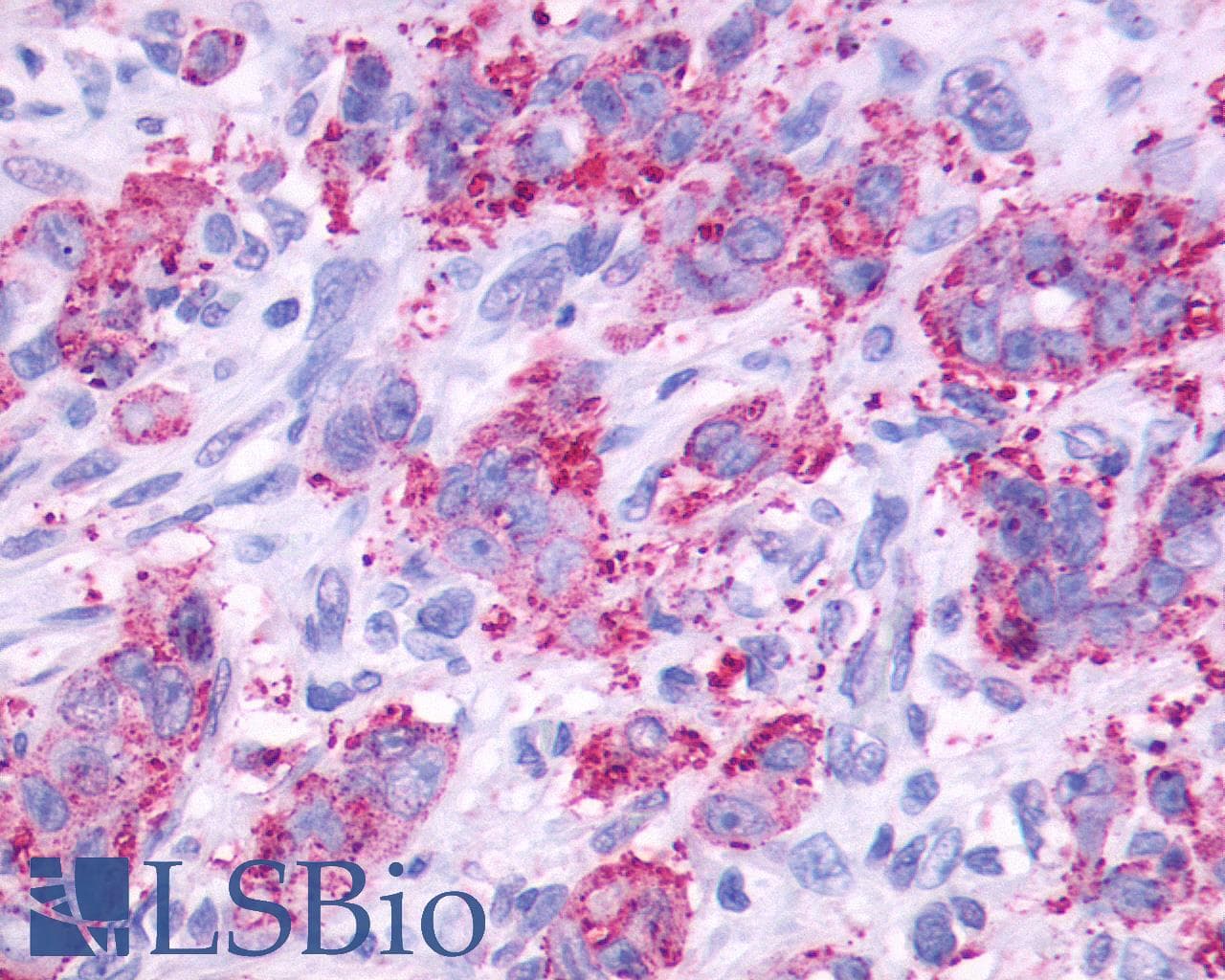 PathPlus™ Polyclonal Rabbit anti-Human CCKBR / Cckb Antibody (Cytoplasmic Domain, IHC)
