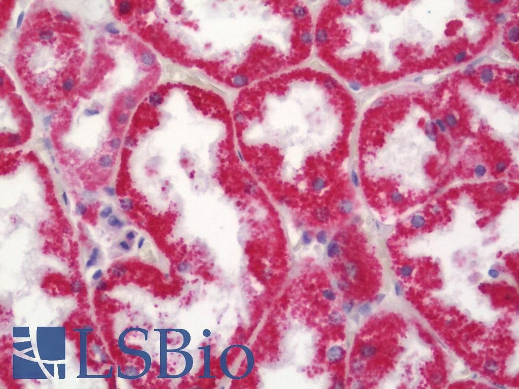 IHC-plus™ Polyclonal Rabbit anti-Human MRPL41 / PIG3 / BMRP Antibody (aa81-130, IHC, WB)