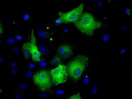 SORD / Sorbitol Dehydrogenase Antibody (clone OTI1D5)